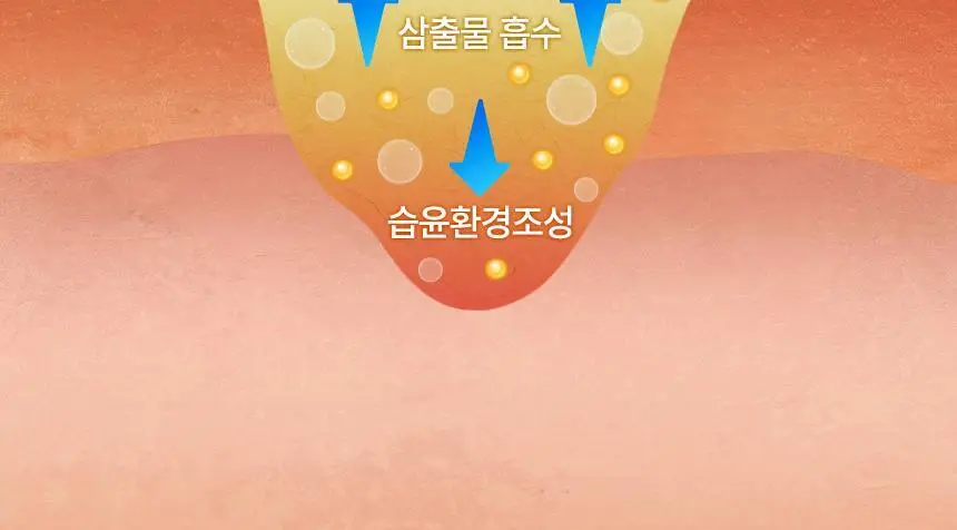 [의료기기]듀오덤 엑스트라씬 3매 상세페이지 14